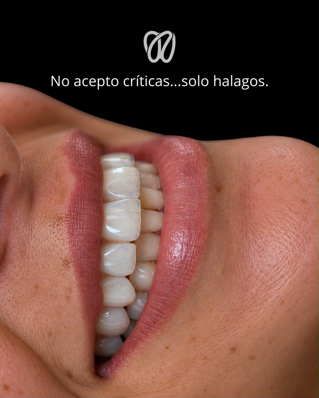 Resultado de diseño de sonrisa